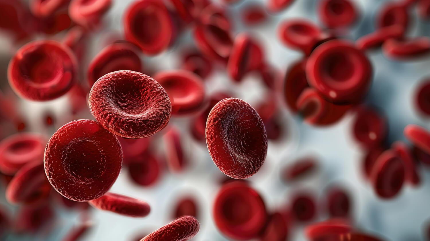 anemia anemia